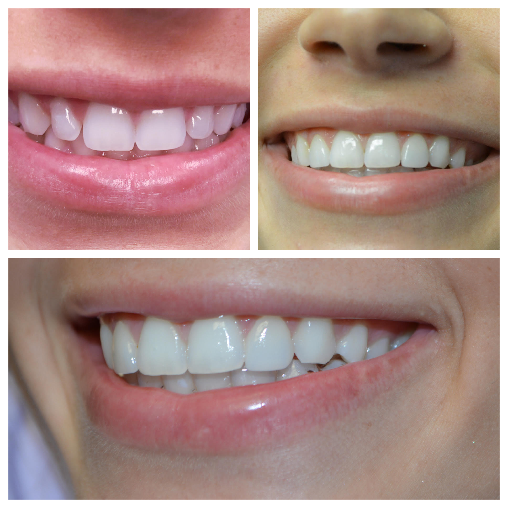 Before and After Image