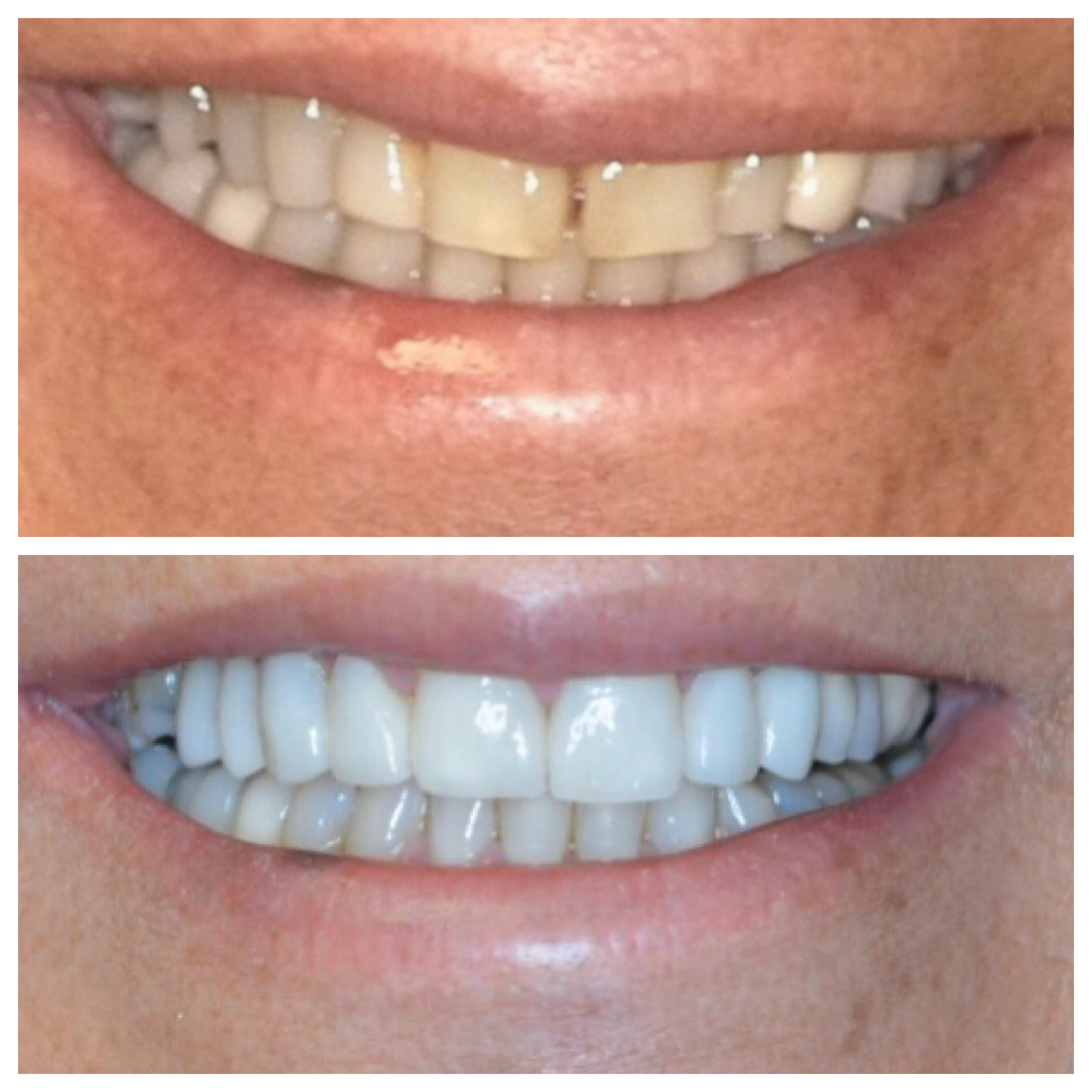 Before and After Image