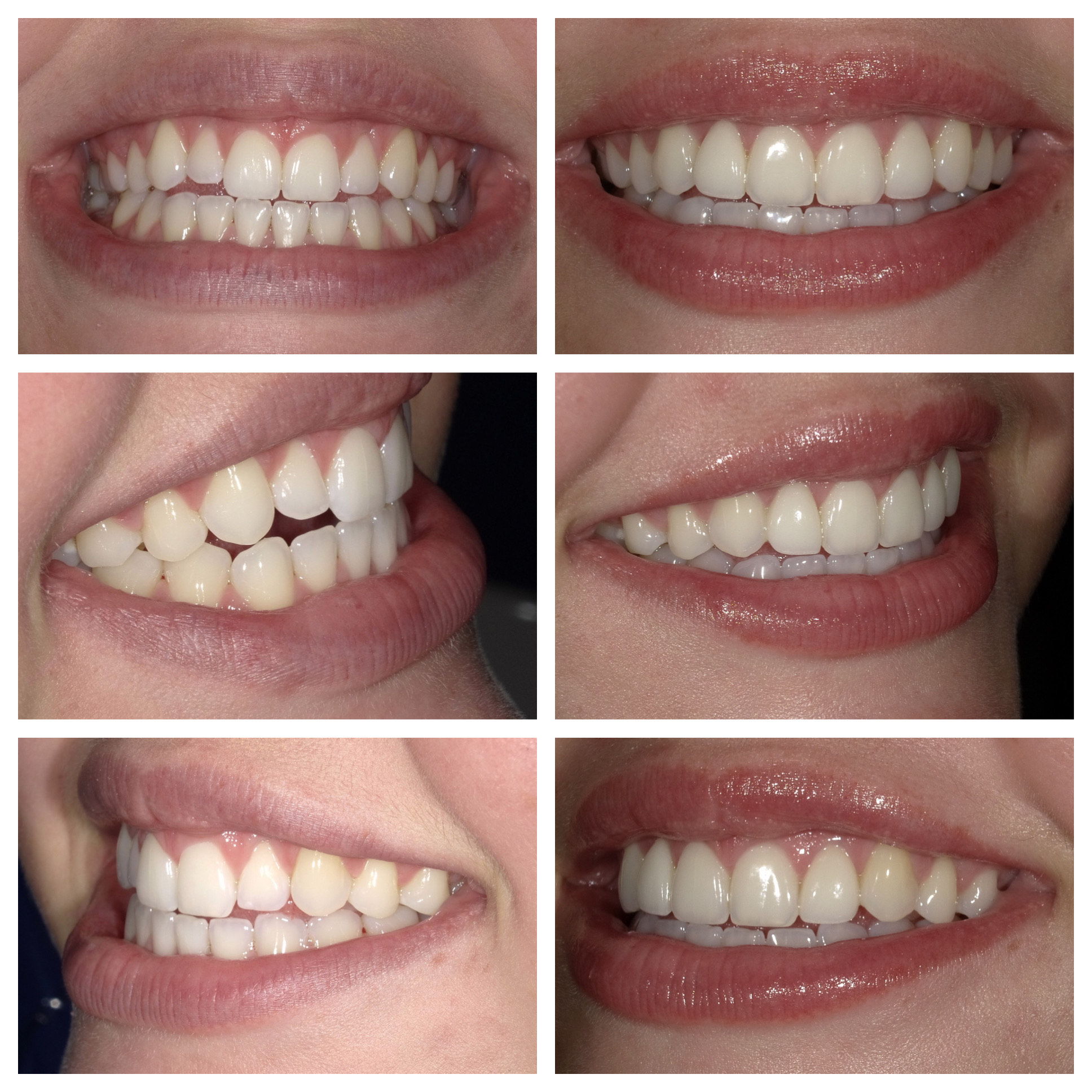 Before and After Image