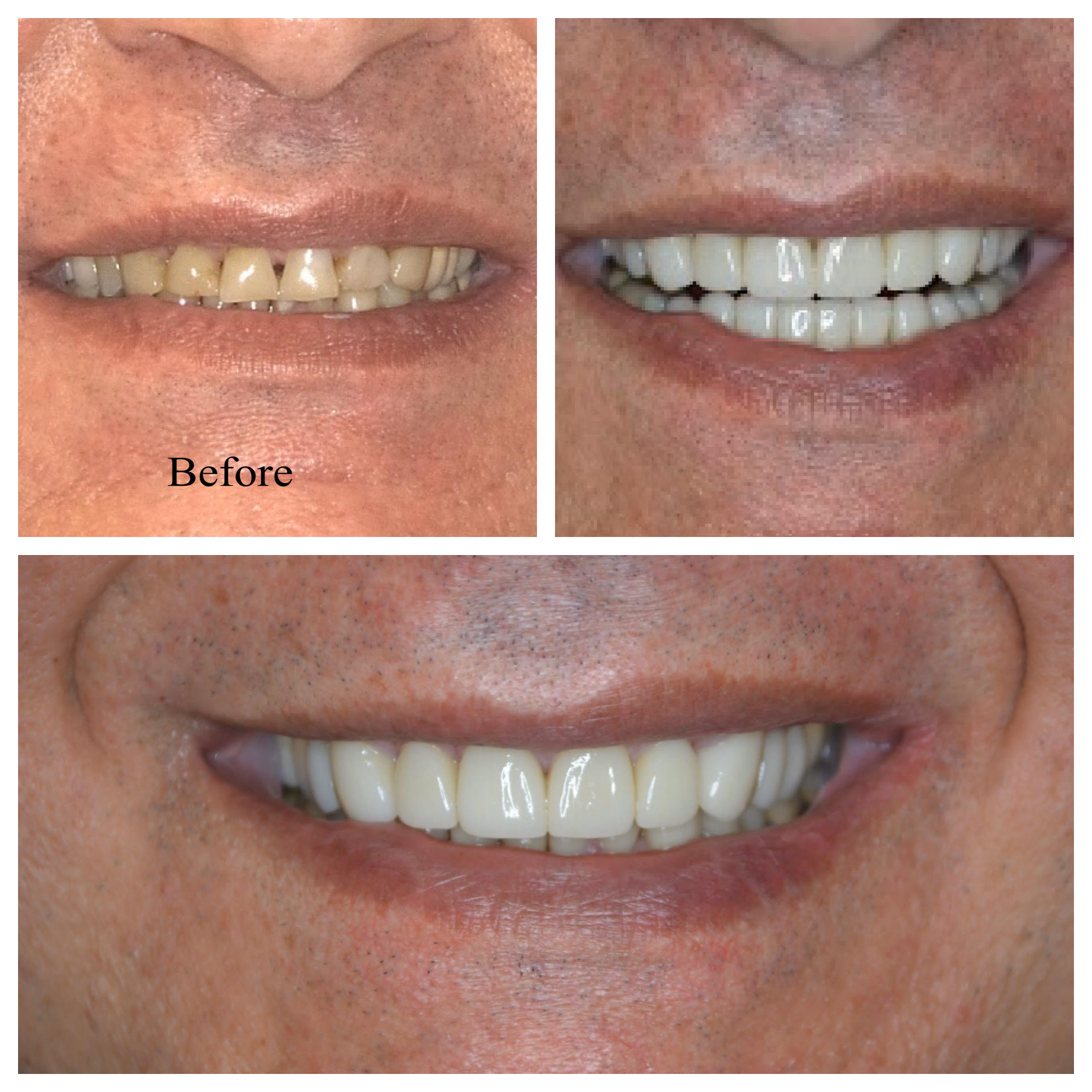 Before and After Image