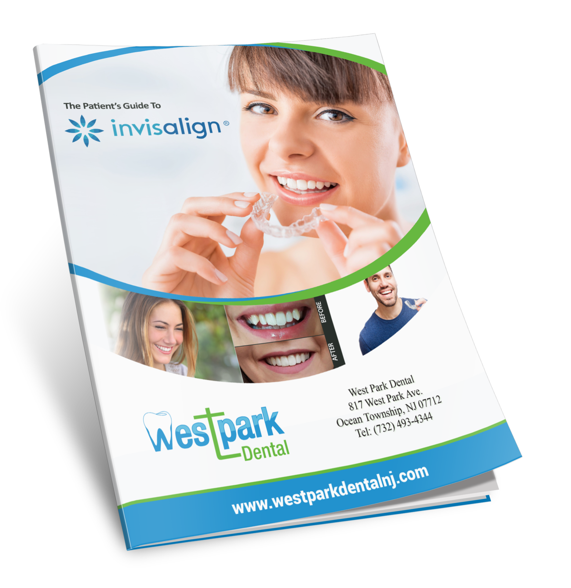 Invisalign Report